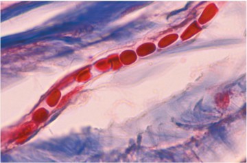 How flexible are your red blood cells? – Microfluidic deformability