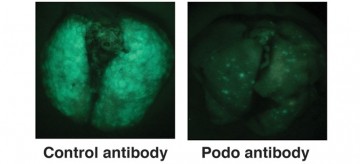 Kelly McNagny group developed an antibody to target the spread of aggressive tumors