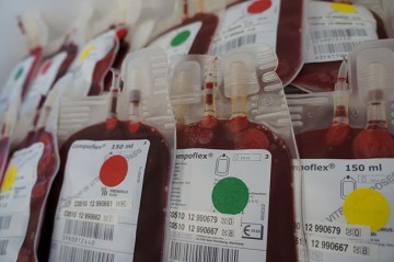 Searching for Alternative Plasticizers for Red Blood Cell Storage Bags