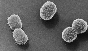 Killing us with Sweetness: Understanding the Role of Protein Glycosylation in Bacteria-related Sepsis