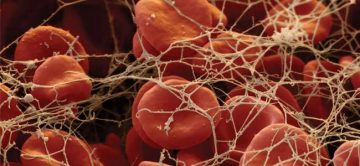 Christian Kastrup’s Team Leads the Way Towards a More Stable Blood Clot