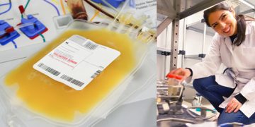 Can Blood Bag Texture Affect Transfusion Safety?