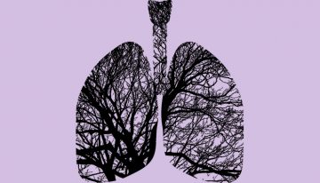 McNagny Lab Uncovers a New Protective Role for an Old Protein During Lung Repair
