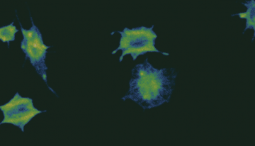 Image of platelets activating their function. Image used for the CBR Magazine April 2022 cover.
