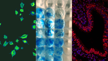 Entries submitted to the CBR Cover Art Contest, April 2022. Three images, from left to right: platelets activating their function, which look like green splashes on a black background; protein corona in a well plate, which looks like blue circles in a well plate; and the staining of HMGB1 in human endometrium, which looks like red and blue dashes in a heart shape on a black background.