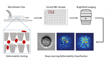 Emerging artificial intelligence methods to assess transfusion quality