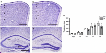 Jefferies Lab publication “The intracellular domain of major histocompatibility class-I proteins is essential for maintaining excitatory spine density and synaptic ultrastructure in the brain”